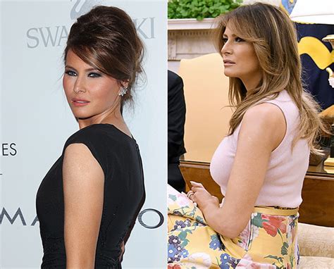 did melania trump get a boob job see before and after pics hollywood life