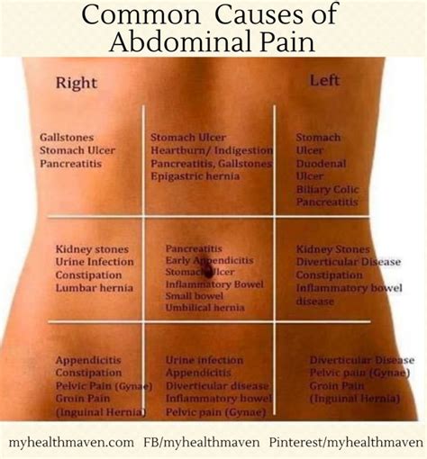 The 25 Best Stomach Pain Chart Ideas On Pinterest Appendix Anatomy