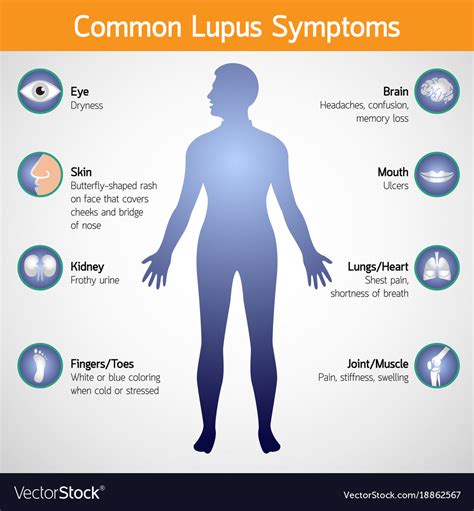 Common Lupus Symptoms Logo Icon Royalty Free Vector Image