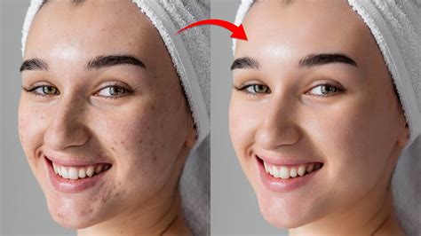 Quickest Way To Retouch Skin In Photoshop Youtube