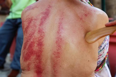 Admin rating 5 of 5 des: Gua Sha Massage: What Is It And Is It Safe? - MindBodyPal