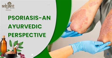 Psoriasis Treatment In Ayurveda