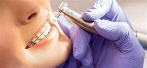Orthodontic Emergency Peabody Braces Emergency Treatment Newburyport