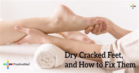 Dry Cracked Feet And How To Fix Them