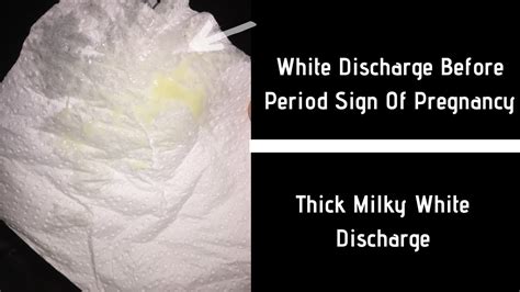 White Discharge Before Period Sign Of Pregnancy