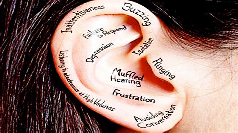 Anxiousness and depression could intensify ringing in the ears. Constant Ringing In The Ears - YouTube