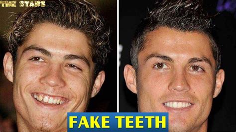 Celebrities With Fake Teeth Youtube