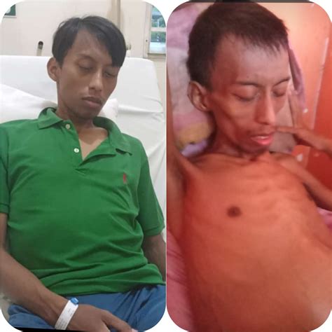 Penderita Tumor Ganas Di Bintan Butuh Perhatian Dan Bantuan Pemerintah