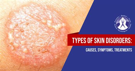 Skin Disorders Pictures