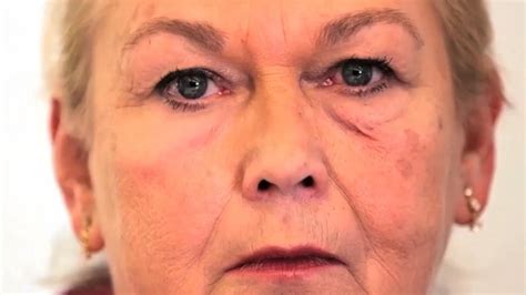 I prefer to use aha's at night to give them more time to work. "Second skin" gel temporarily tightens wrinkles - YouTube