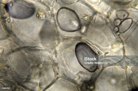 Mikrograf Pati Kentang Foto Stok Unduh Gambar Sekarang Biologi