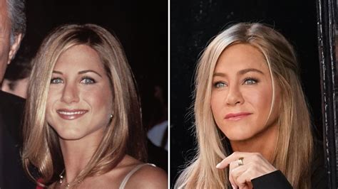 Has Jennifer Aniston Had Plastic Surgery Comments Procedures