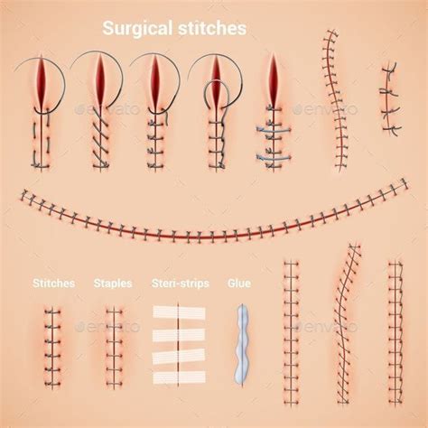 Surgical Stitches Infographic Set Medical School Essentials Medical
