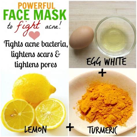 How To Get Rid Of Your Acnes Naturally At Home Fashion Corner