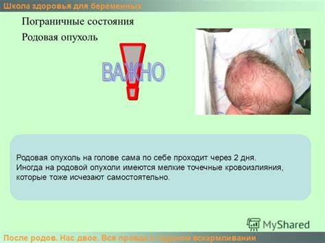 Как питаться после родов при грудном вскармливании чтобы похудеть