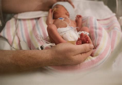 Premature Babies At 20 Weeks
