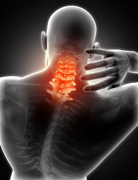Neck Pain Perth Chiropractic Clinic Treatment Burswood Health