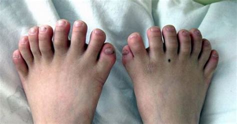 10 Of The Worlds Craziest Medical Conditions Thatviralfeed