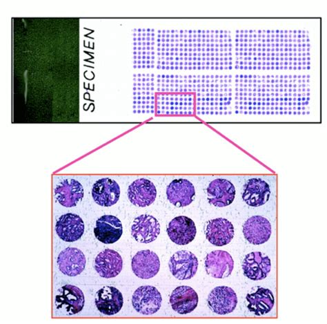 A Tissue Microarray Microscopic Slide Showing Numerous Punched Tissue