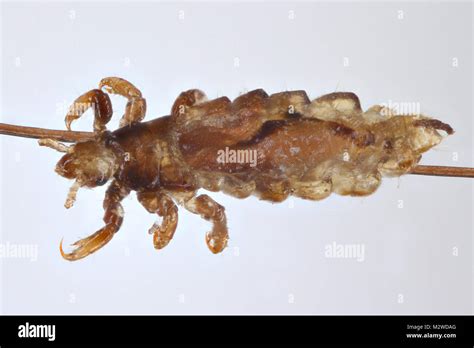 Body Louse Hi Res Stock Photography And Images Alamy