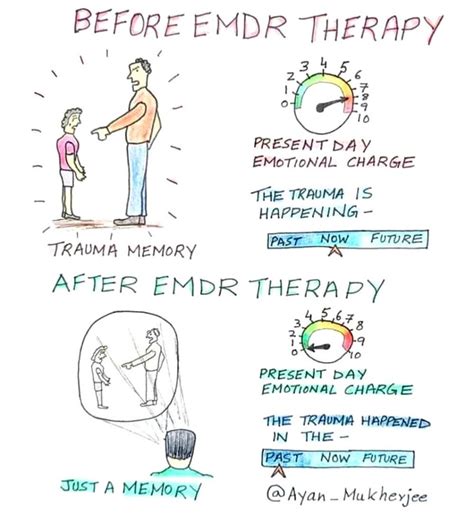 What Is Emdr Therapy Kells Counselling