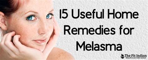 15 Powerful Remedies For Melasma Face Pigmentation At Home