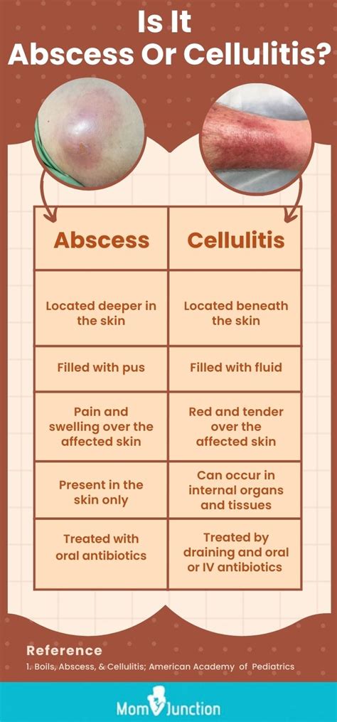 Understanding And Addressing Cellulitis And Abscesses A Guide The