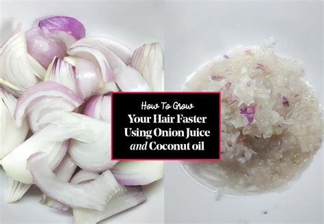 How To Grow Your Hair Faster Using Onion Juice And Coconut Oil Thrive