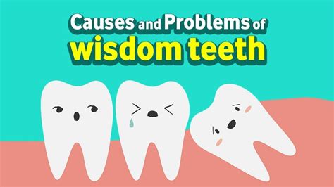 What Are The Causes And Problems Of Wisdom Teeth Youtube