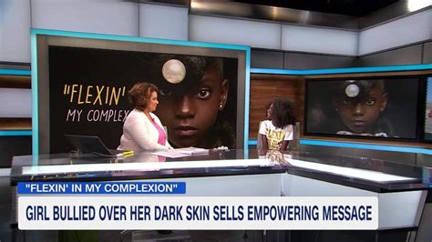 Girl Bullied Over Her Dark Skin Sells Empowering Message Cnn Video