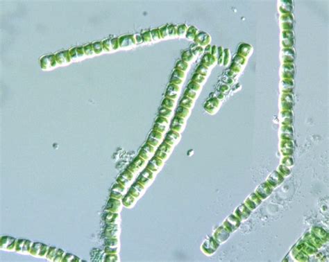 Protist Images Filamentous Algae