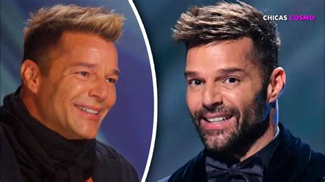 Ricky Martin Sorprende Con Nuevo Rostro Desatando Rumores De Posible