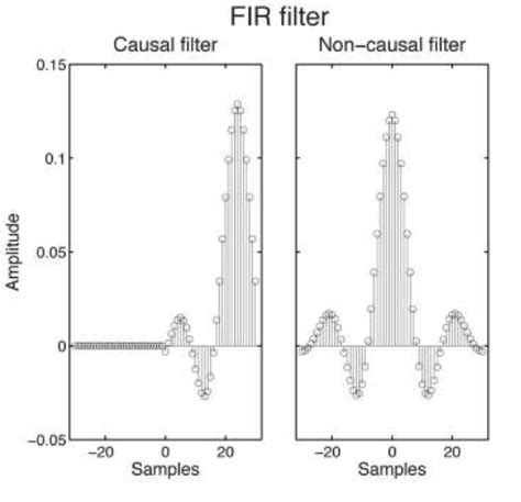 Pitfalls Of Filtering The Eeg Signal Sapien Labs Neuroscience