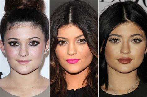 thanks to kylie jenner more and more women are getting lip injections ewmoda