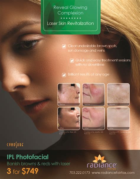 Ipl Photofacial Discounts