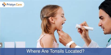 Tonsil Grading Standardized Grading Of Tonsil Size Pristyn Care