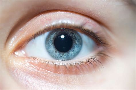 Dilated Pupils Causes And What To Do