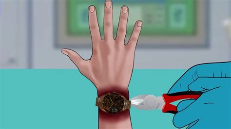 [asmr Animation] Are You Wearing Your Watch Too Tight Be Careful When Wearing The Watch Too