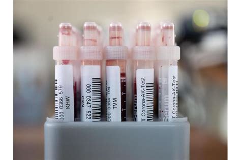Helmholtz Institut Bundesweit 60 000 Blutproben Auswerten