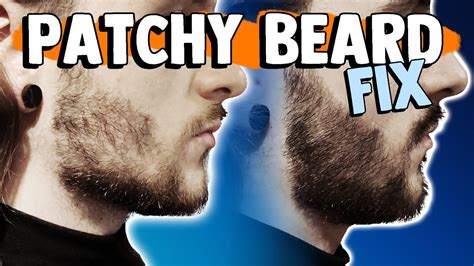 How To Fix A Patchy Beard 6 Methods To Fix Your Patchy Beard Youtube