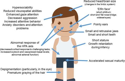 Williams Syndrome And Autism In The Same Child Mapping Ignorance