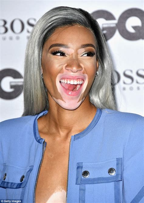 Winnie Harlow Unveils A Bold New Do As She Shows Off Her Long Legs In