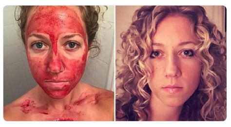 Feminist Smears Menstrual Blood On Her Face To Show Periods Are