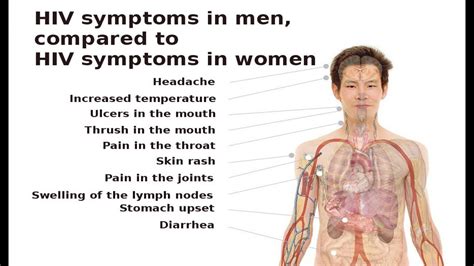 Hiv Symptoms In Men Youtube