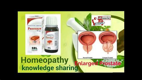 Homeopathic Medicine For Prostate Enlargement Youtube