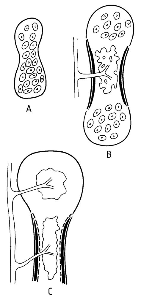 A±c Diagram Of Intramembranous Ossification Of Tubular Bone A