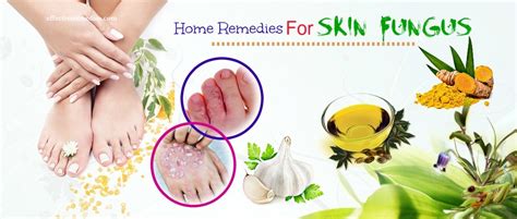 25 Effective Home Remedies For Skin Fungus On Hands And Feet