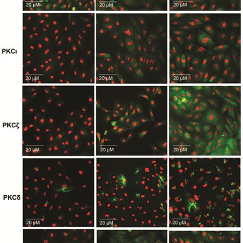 Expression Of Pkc Isoforms In Arpe19 Cells C Download Scientific