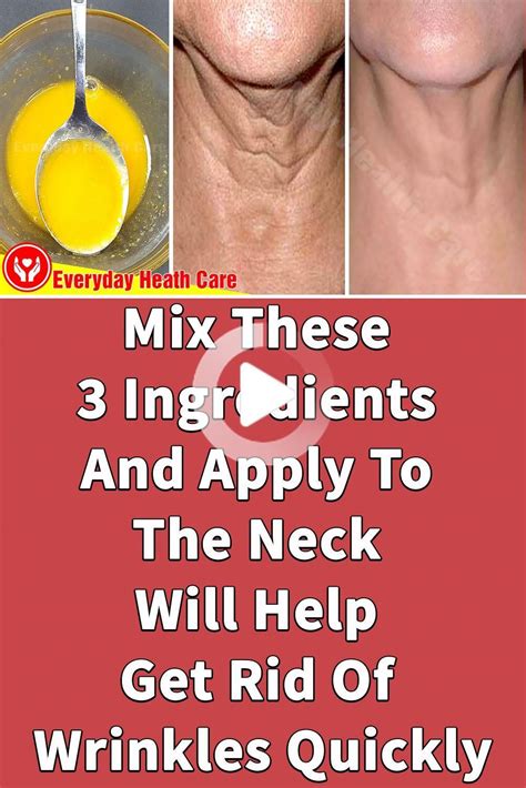 Mix These 3 Ingredients And Apply To The Neck Will Help Get Rid Of