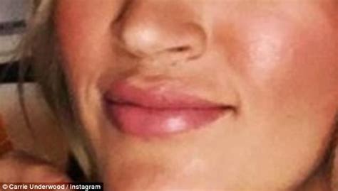 Carrie Underwood Offers Up Glimpse Of Lip Scar In Sporty Instagram Post Daily Mail Online